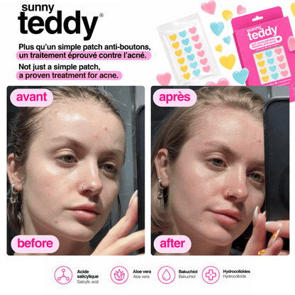 Sunny Teddy Pimple Patches - 72 Multicolor Hearts