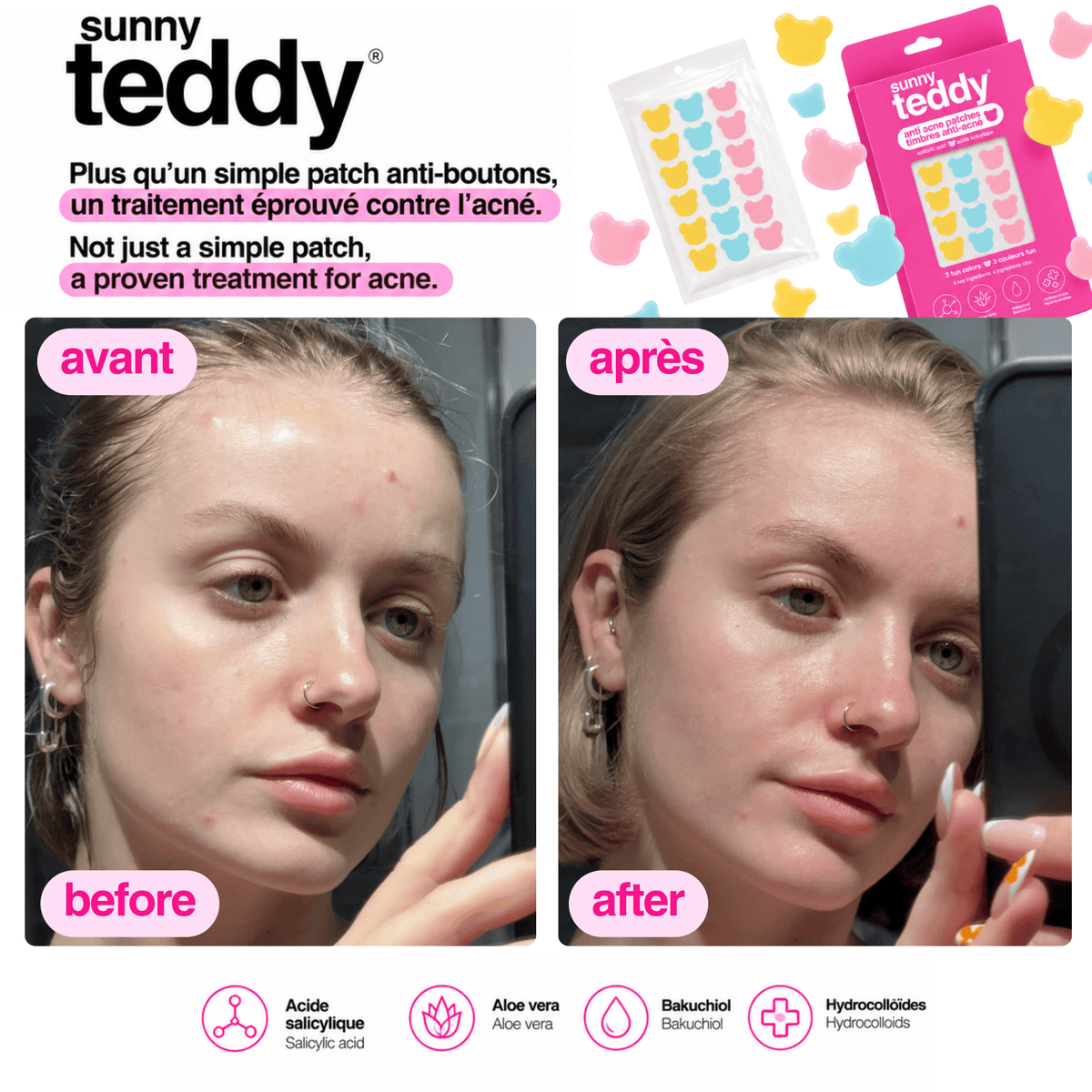 Sunny Teddy Pimple Patches - 72 Multicolor Teddies