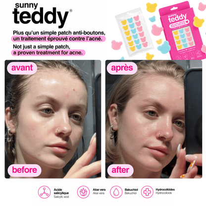 Sunny Teddy Pimple Patches - 72 Multicolor Teddies
