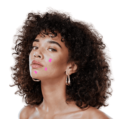 Timbres Anti-Acné à l'Acide Salicylique - 36 Teddies Roses