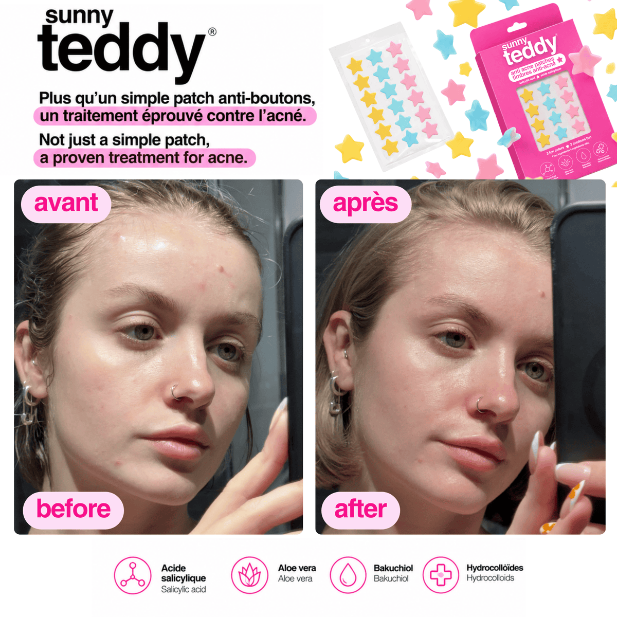 Sunny Teddy Multicolor Pack - 108 Salicylic Patches