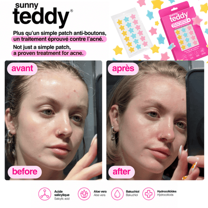 Sunny Teddy Multicolor Pack - 108 Salicylic Patches