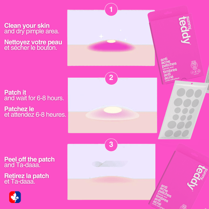 Pimple Patches with Salicylic Acid - 72 Transparent Dots