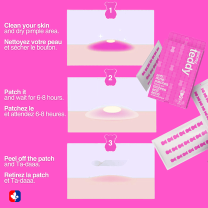 Pimple Patches with Salicylic Acid - 72 Pink Teddies