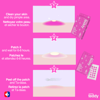 Sunny Teddy Pimple Patches - 36 Pink Stars