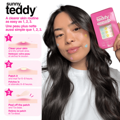 Sunny Teddy Pimple Patches - 72 Multicolor Stars